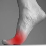 तलवे में दर्द, पैर में दर्द, Foot Pain, Sole Pain, Health Tips, Walking Pain, मेटाटार्सलजिया, पैरों की देखभाल, गठिया, स्वास्थ्य समाचार