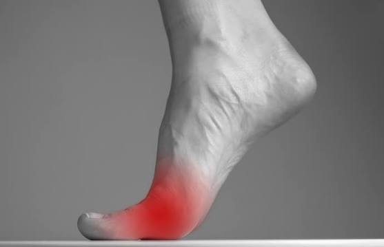 तलवे में दर्द, पैर में दर्द, Foot Pain, Sole Pain, Health Tips, Walking Pain, मेटाटार्सलजिया, पैरों की देखभाल, गठिया, स्वास्थ्य समाचार