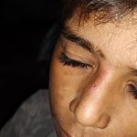Etah News: 11 साल के बच्चे से मारपीट, कब्रिस्तान तक घसीटा; दो आरोपियों पर केस